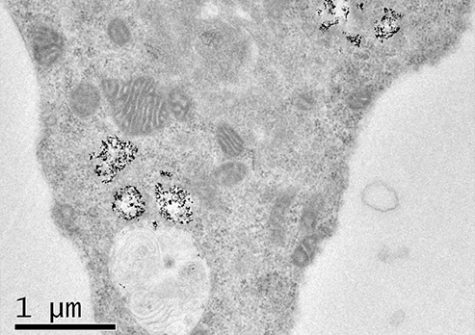 cellule vue par microscopie électronique