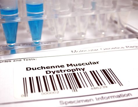 Généthon essai clinique myopathie Duchenne