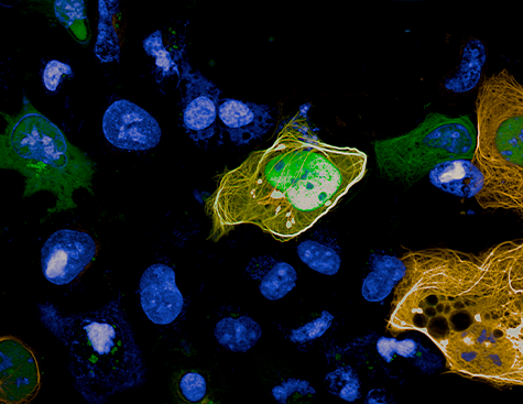 Visualisation et quantification par la technologie MTBench des interactions protéines-protéines, observées à l'Opera Phenix+ dans une lignée cellulaire.