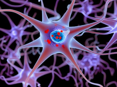 Le laboratoire SABNP a découvert pourquoi, dans la maladie de Charcot, les agrégats pathologiques des neurones sont essentiellement constitués de la protéine TDP43, et comment l’agrégation s’opère.