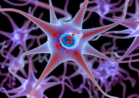 Le laboratoire SABNP a découvert pourquoi, dans la maladie de Charcot, les agrégats pathologiques des neurones sont essentiellement constitués de la protéine TDP43, et comment l’agrégation s’opère.