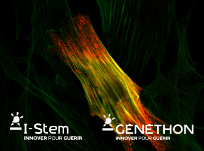 I-Stem et Généthon identifie le biomarqueur DAB2 comme cible thérapeutique potentielle pour plusieurs dystrophies musculaires