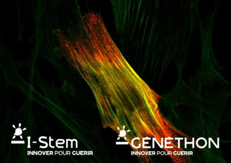 I-Stem et Généthon identifie le biomarqueur DAB2 comme cible thérapeutique potentielle pour plusieurs dystrophies musculaires