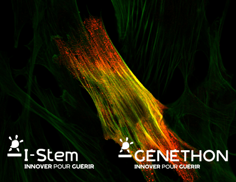 I-Stem et Généthon identifie le biomarqueur DAB2 comme cible thérapeutique potentielle pour plusieurs dystrophies musculaires
